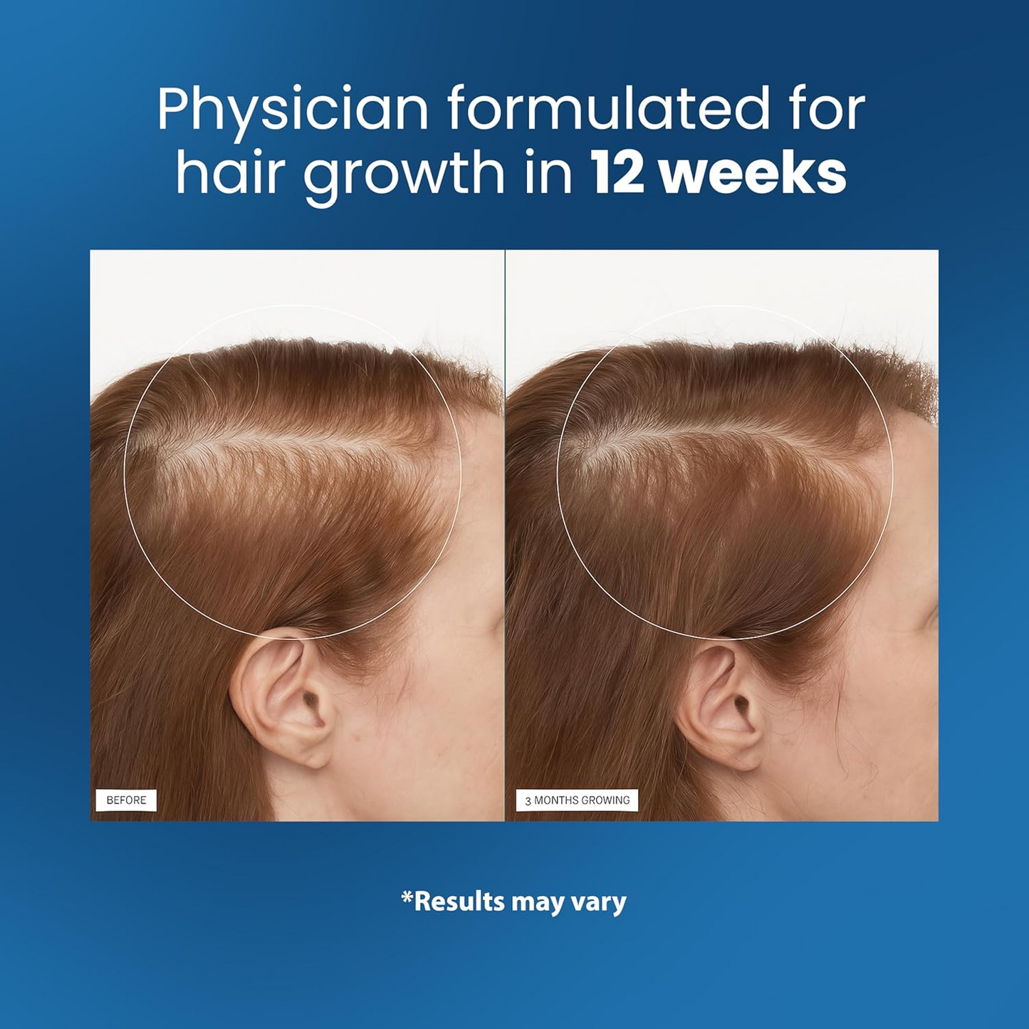 Hair Growth Serum